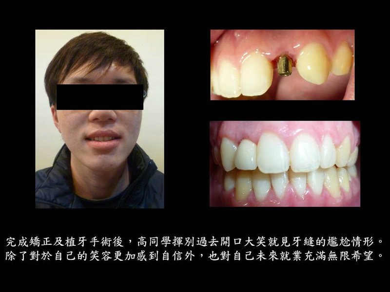 投影片4.JPG